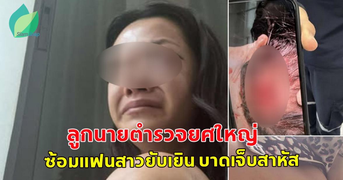 เพจดังแฉ! ลูกนายตำรวจยศใหญ่ ซ้อมแฟนสาวยับเยิน บาดเจ็บสาหัส